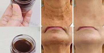Anti-Aging Magic Oil: Coffee Oil That Erases Wrinkles and Is Stronger than Botox!