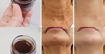 Anti-Aging Magic Oil: Coffee Oil That Erases Wrinkles and Is Stronger than Botox!
