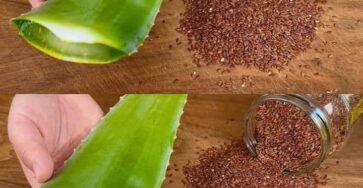Aloe Vera and Flaxseed for Youthful Skin A Natural Alternative to Botox at Home