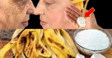 Natural Remedy for Skin Imperfections: Banana Peels and Baking Soda