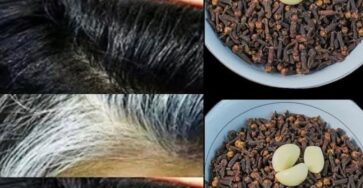 Search Results for: Natural Hair Darkening Remedy: Cloves and Garlic