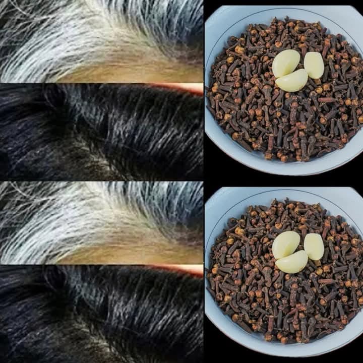 Search Results for: Natural Hair Darkening Remedy: Cloves and Garlic